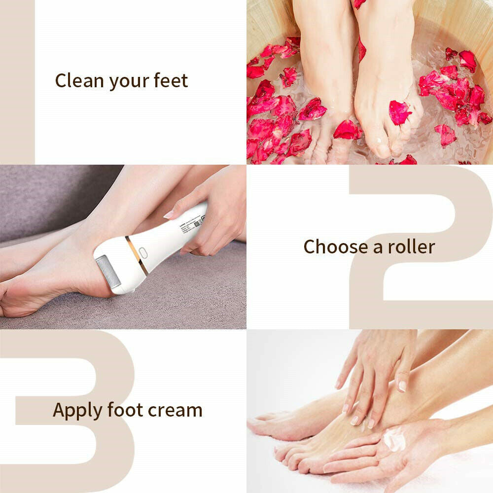 Callus remover - Soft feet